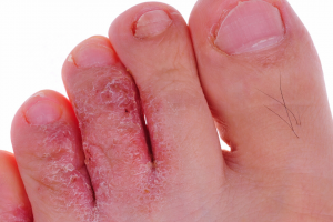Podiatrist Near Holbrook