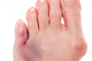 Podiatrist Services Near Oakdale NY