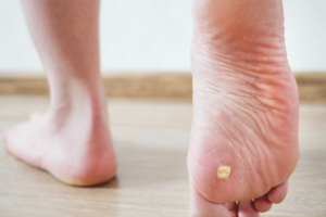 podiatrist in Islandia