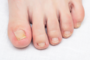 Podiatrist near Holbrook