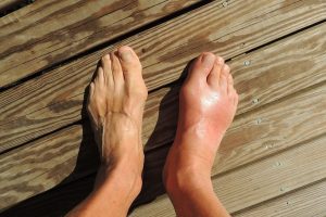Foot Doctor In Ronkonkoma