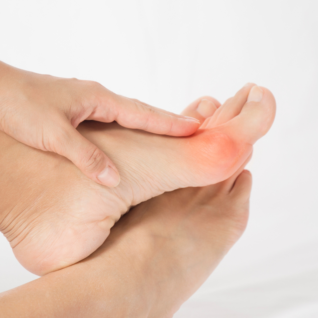 How Do You Relieve Bunion Pain? Jeffrey S Muroff DPM New York